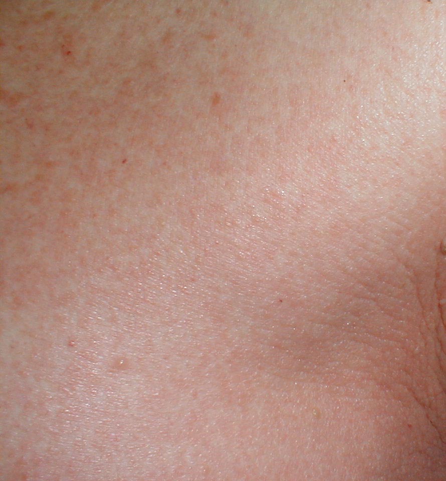 البوابة الطبية | أخبار يومية لحياة صحية