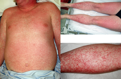 البوابة الطبية | أخبار يومية لحياة صحية