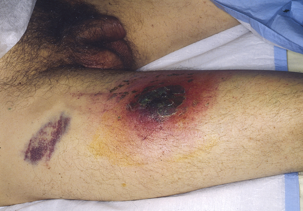 البوابة الطبية | أخبار يومية لحياة صحية