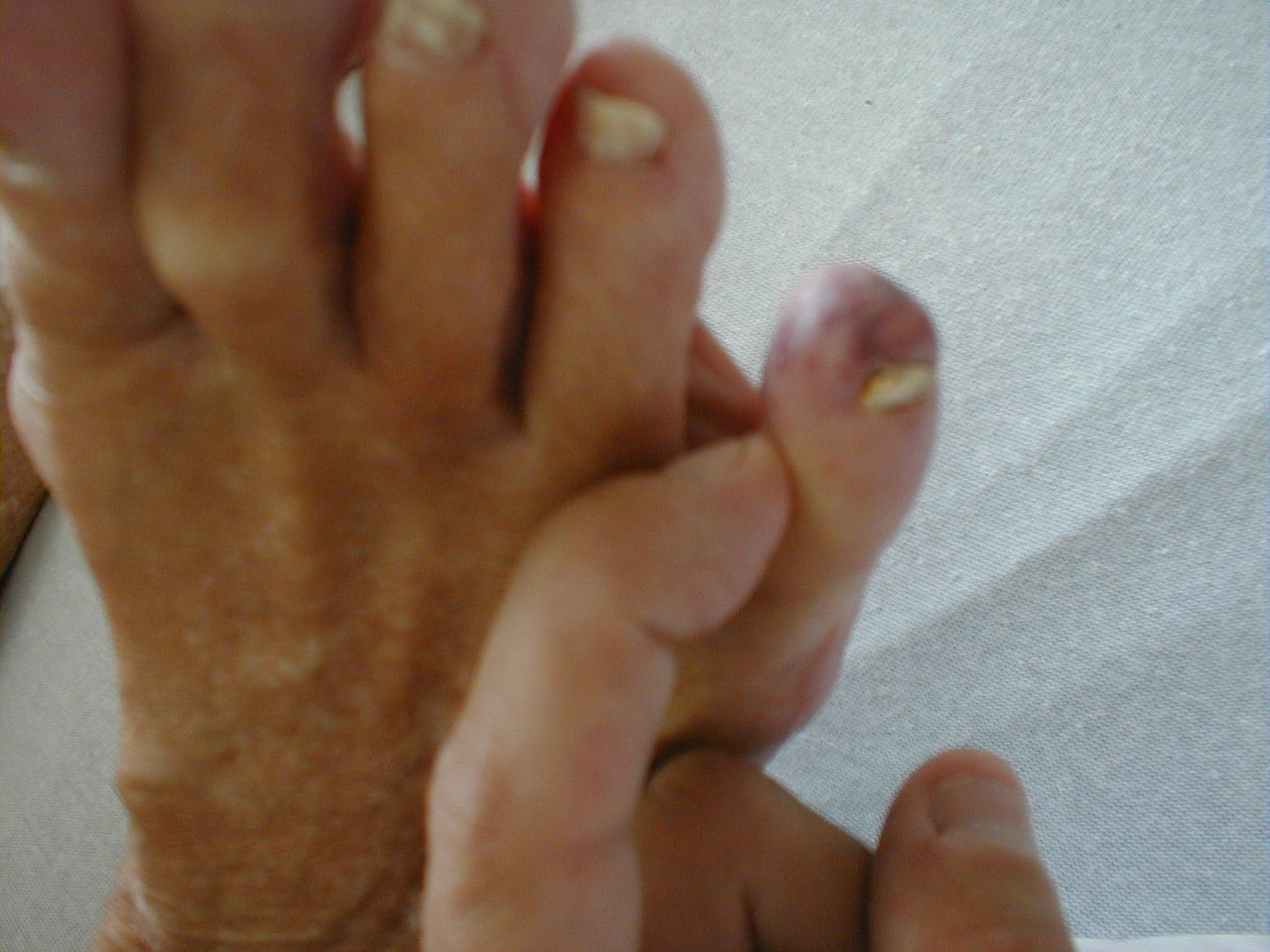 البوابة الطبية | أخبار يومية لحياة صحية