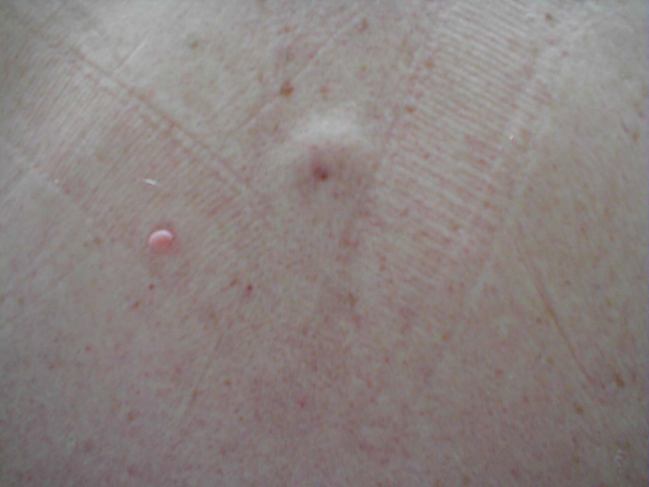 البوابة الطبية | أخبار يومية لحياة صحية