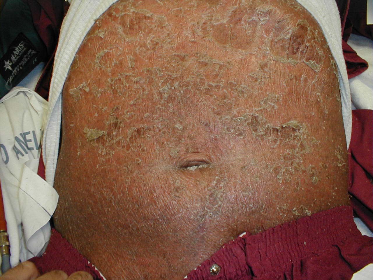 البوابة الطبية | أخبار يومية لحياة صحية