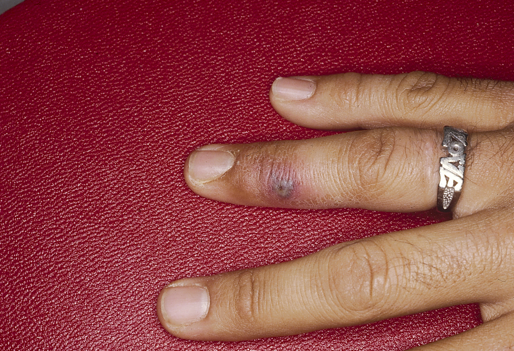 البوابة الطبية | أخبار يومية لحياة صحية