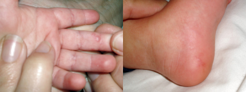 البوابة الطبية | أخبار يومية لحياة صحية