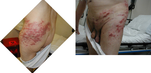 البوابة الطبية | أخبار يومية لحياة صحية