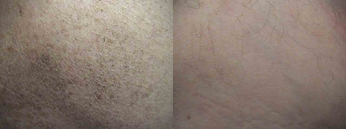 البوابة الطبية | أخبار يومية لحياة صحية