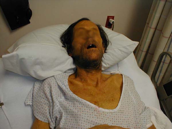 البوابة الطبية | أخبار يومية لحياة صحية