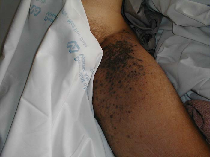 البوابة الطبية | أخبار يومية لحياة صحية