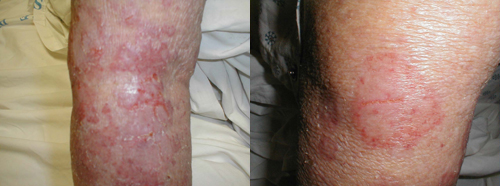 البوابة الطبية | أخبار يومية لحياة صحية