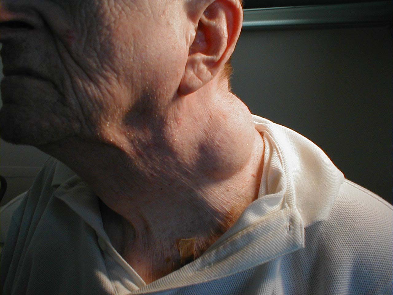 البوابة الطبية | أخبار يومية لحياة صحية