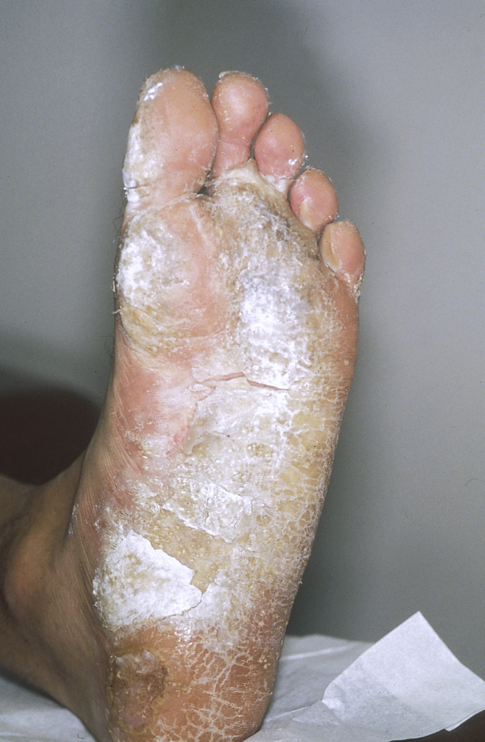 البوابة الطبية | أخبار يومية لحياة صحية