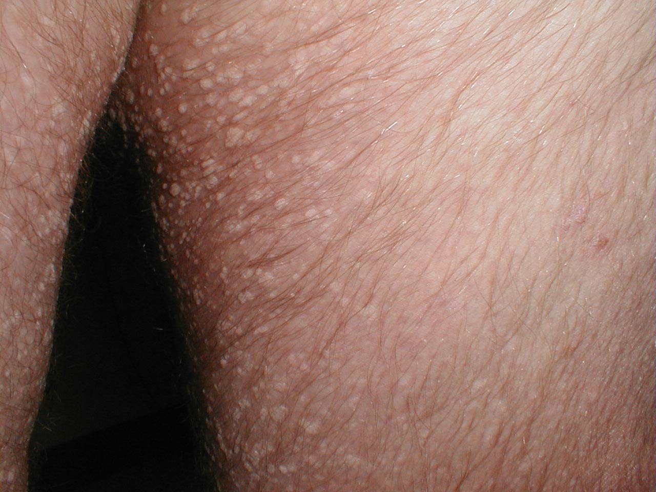 البوابة الطبية | أخبار يومية لحياة صحية