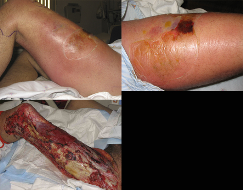 البوابة الطبية | أخبار يومية لحياة صحية