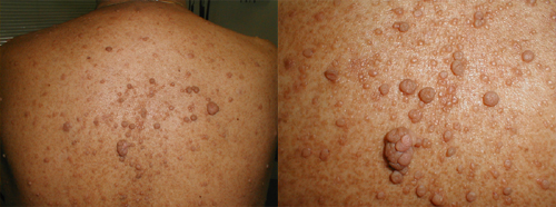 البوابة الطبية | أخبار يومية لحياة صحية