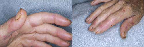 البوابة الطبية | أخبار يومية لحياة صحية