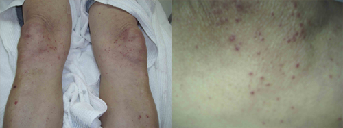 البوابة الطبية | أخبار يومية لحياة صحية