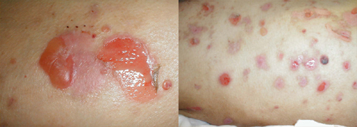 البوابة الطبية | أخبار يومية لحياة صحية