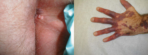 البوابة الطبية | أخبار يومية لحياة صحية