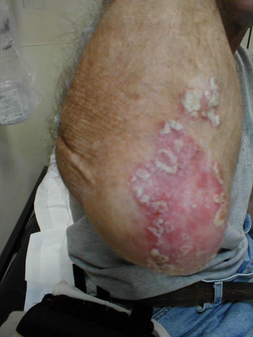 البوابة الطبية | أخبار يومية لحياة صحية