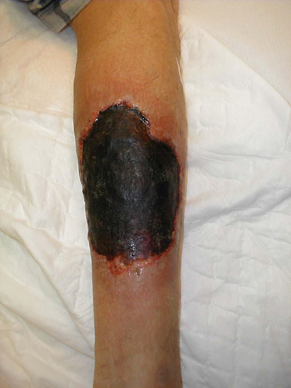 البوابة الطبية | أخبار يومية لحياة صحية