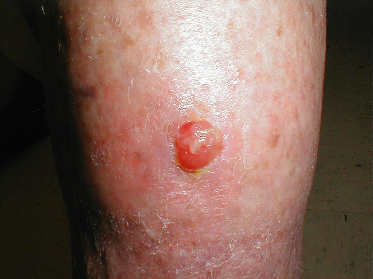 البوابة الطبية | أخبار يومية لحياة صحية