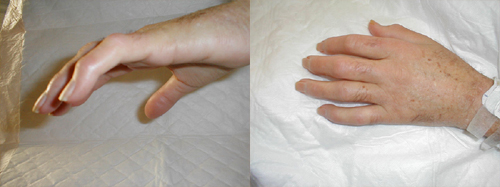 البوابة الطبية | أخبار يومية لحياة صحية