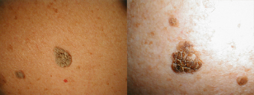 البوابة الطبية | أخبار يومية لحياة صحية