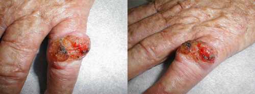 البوابة الطبية | أخبار يومية لحياة صحية