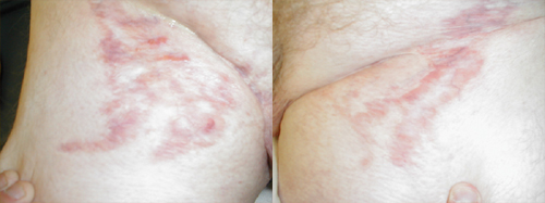 البوابة الطبية | أخبار يومية لحياة صحية