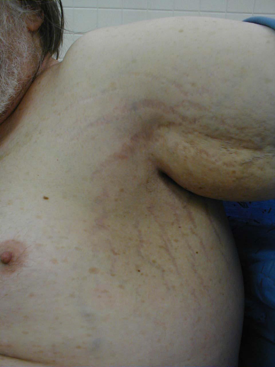 البوابة الطبية | أخبار يومية لحياة صحية