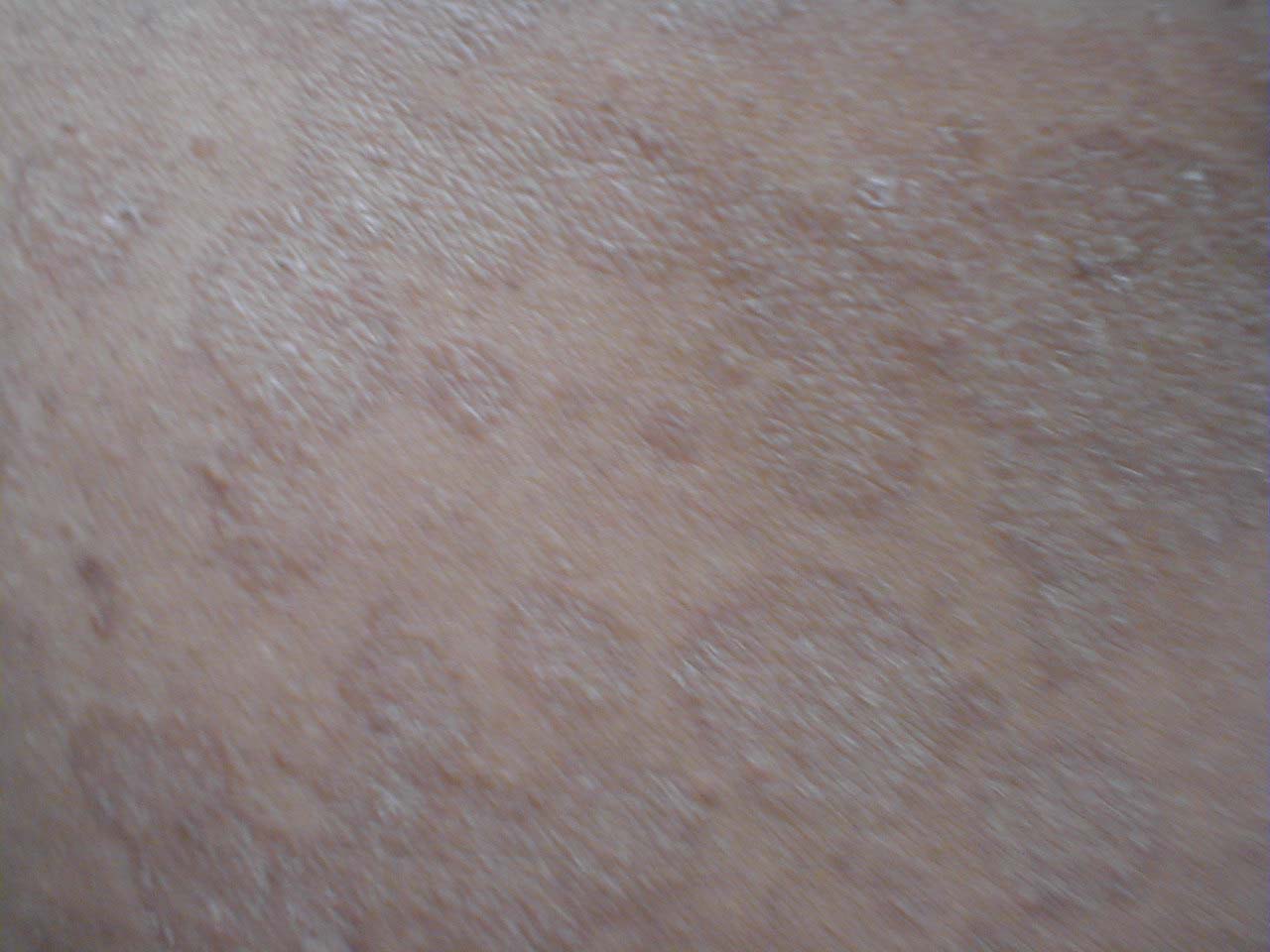 البوابة الطبية | أخبار يومية لحياة صحية