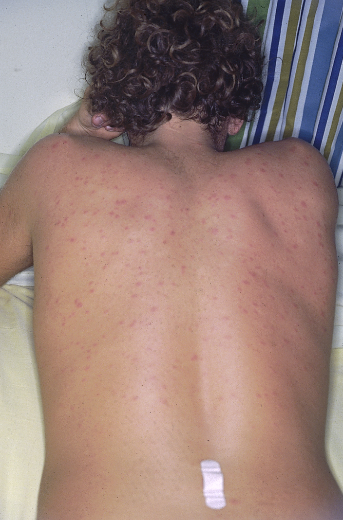 البوابة الطبية | أخبار يومية لحياة صحية