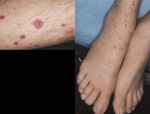 البوابة الطبية | أخبار يومية لحياة صحية