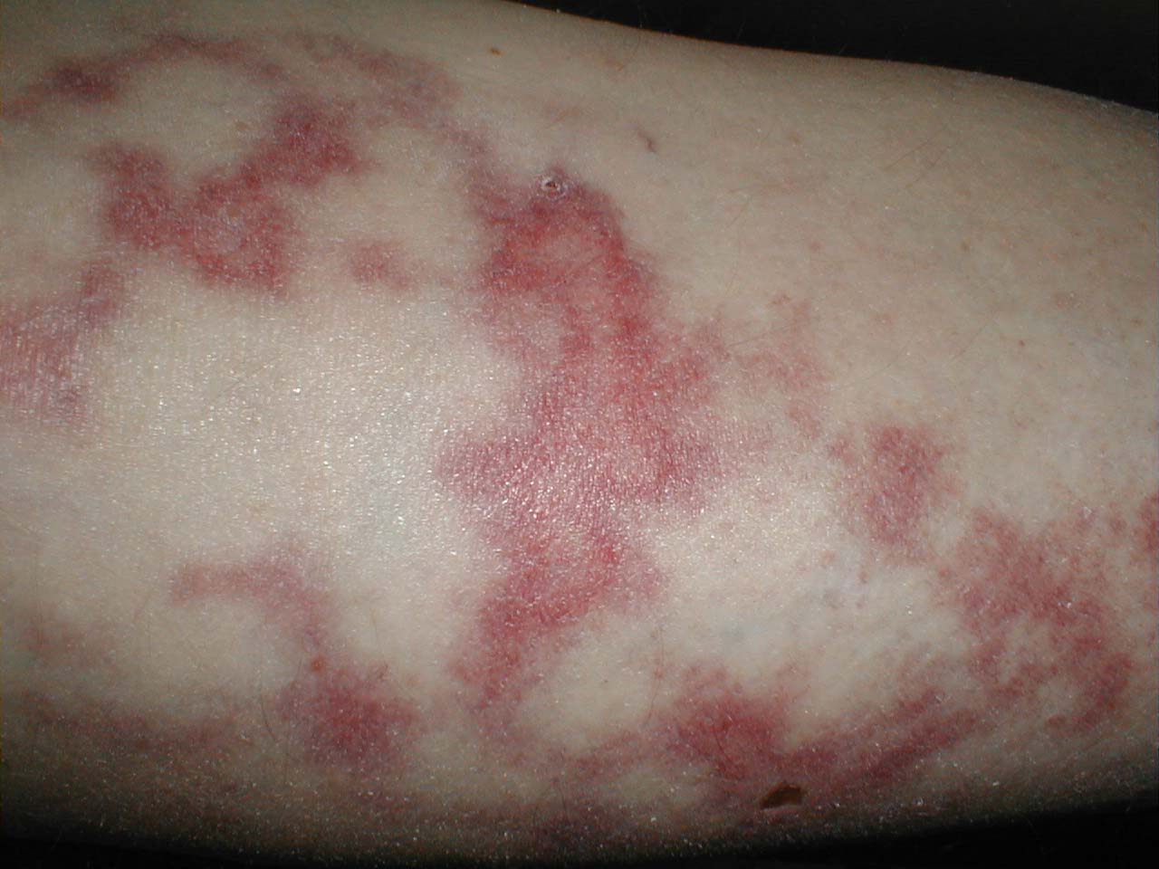 البوابة الطبية | أخبار يومية لحياة صحية