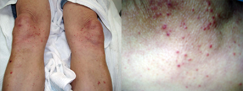 البوابة الطبية | أخبار يومية لحياة صحية