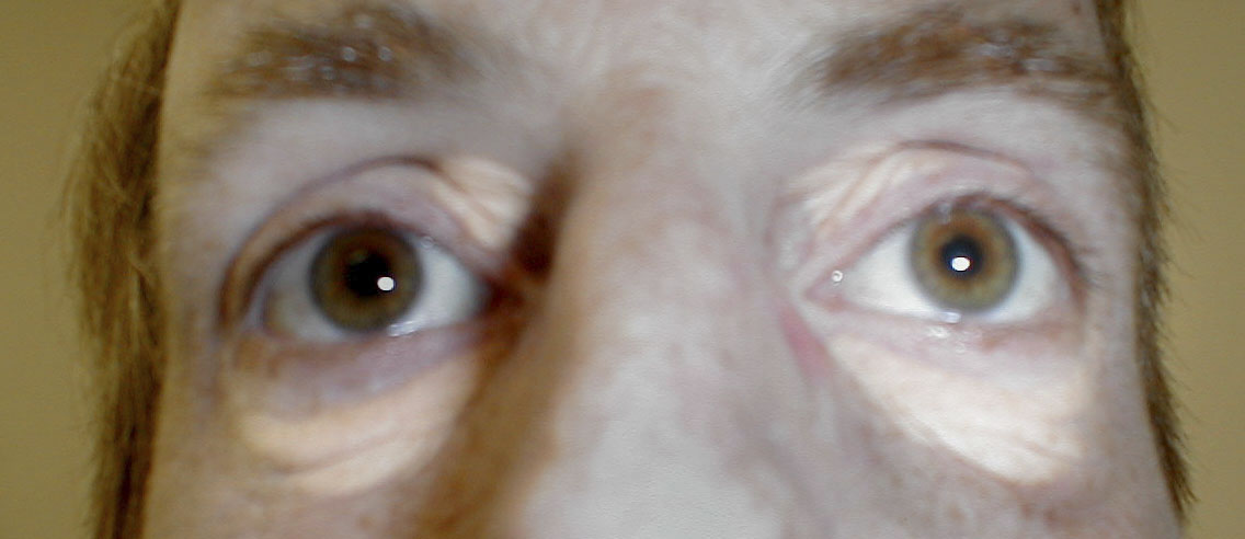 البوابة الطبية | أخبار يومية لحياة صحية