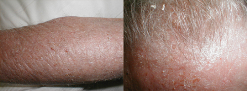 البوابة الطبية | أخبار يومية لحياة صحية