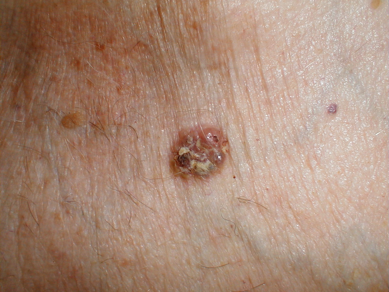 البوابة الطبية | أخبار يومية لحياة صحية