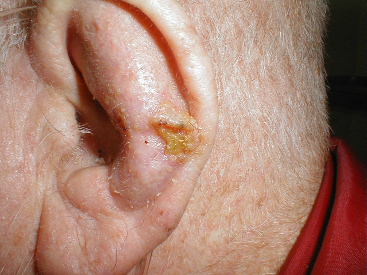 البوابة الطبية | أخبار يومية لحياة صحية