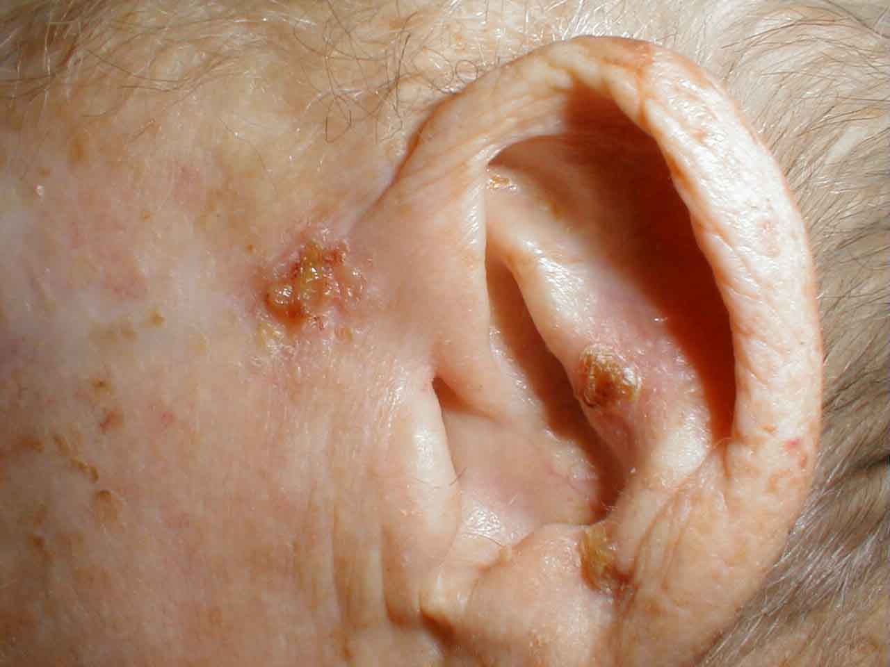 البوابة الطبية | أخبار يومية لحياة صحية