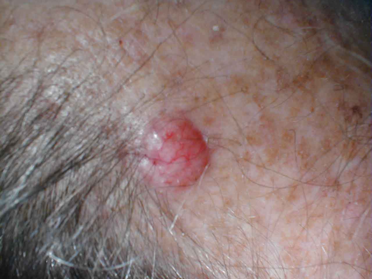 البوابة الطبية | أخبار يومية لحياة صحية