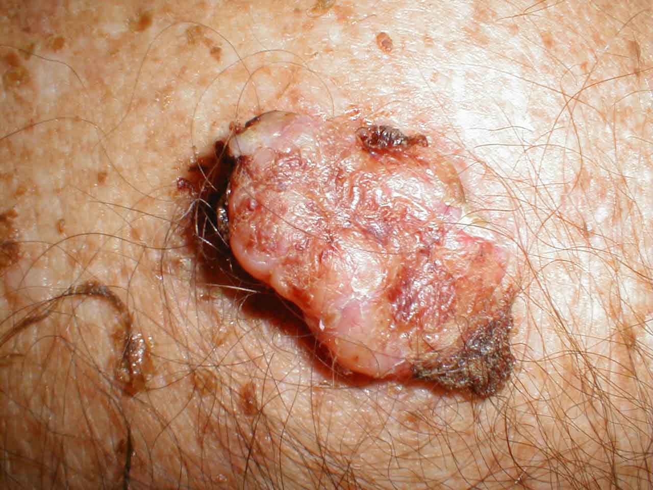 البوابة الطبية | أخبار يومية لحياة صحية