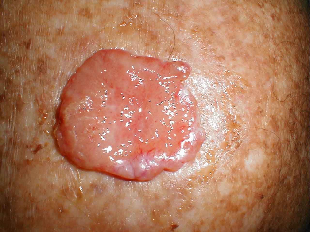 البوابة الطبية | أخبار يومية لحياة صحية