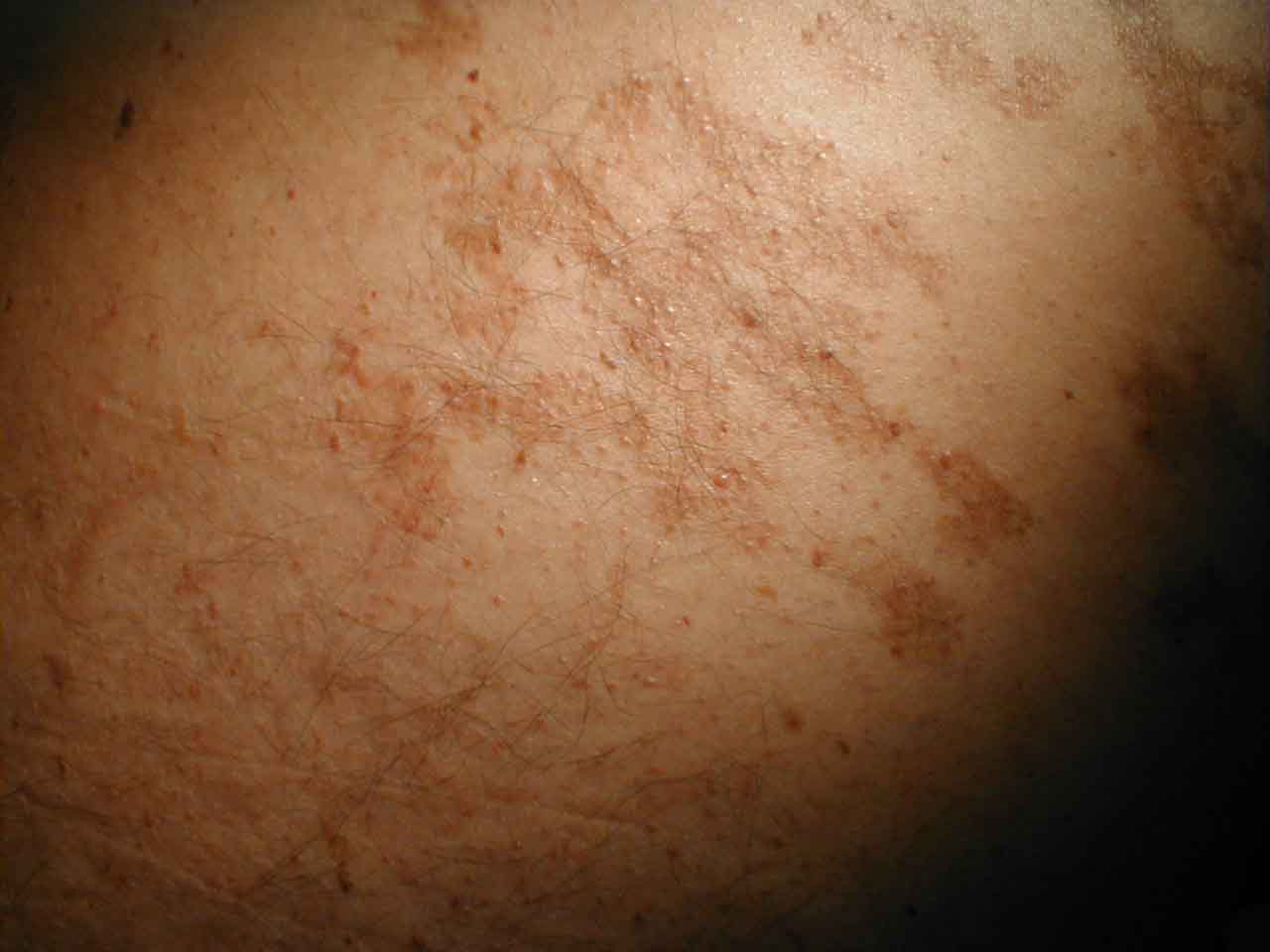 البوابة الطبية | أخبار يومية لحياة صحية