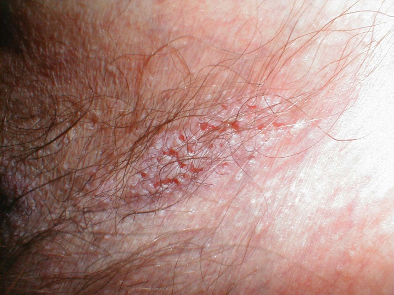 البوابة الطبية | أخبار يومية لحياة صحية