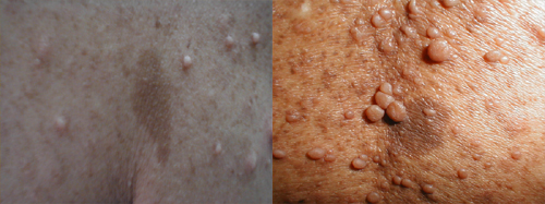 البوابة الطبية | أخبار يومية لحياة صحية