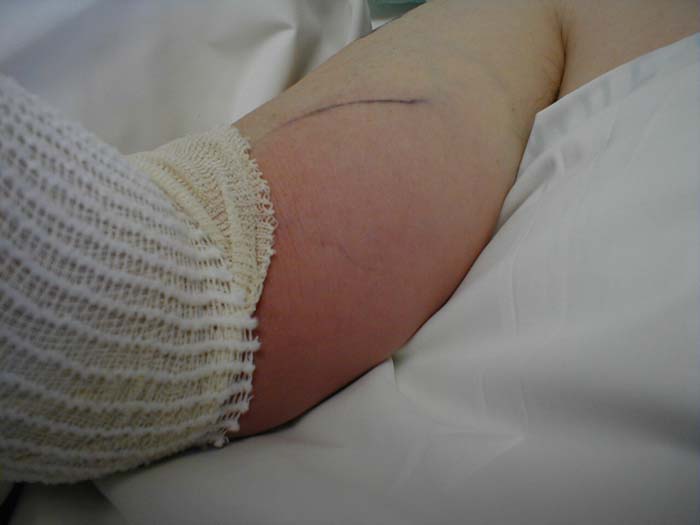 البوابة الطبية | أخبار يومية لحياة صحية