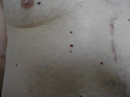 البوابة الطبية | أخبار يومية لحياة صحية