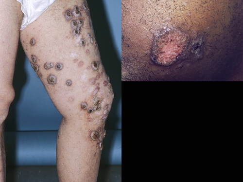 البوابة الطبية | أخبار يومية لحياة صحية