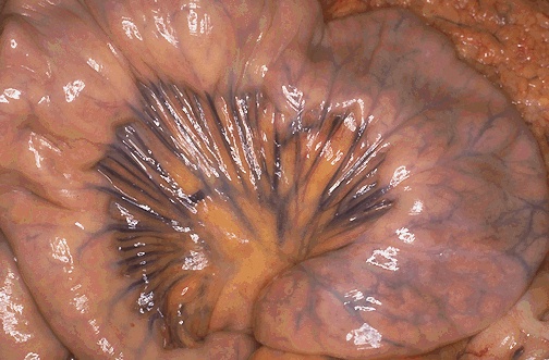 البوابة الطبية | أخبار يومية لحياة صحية